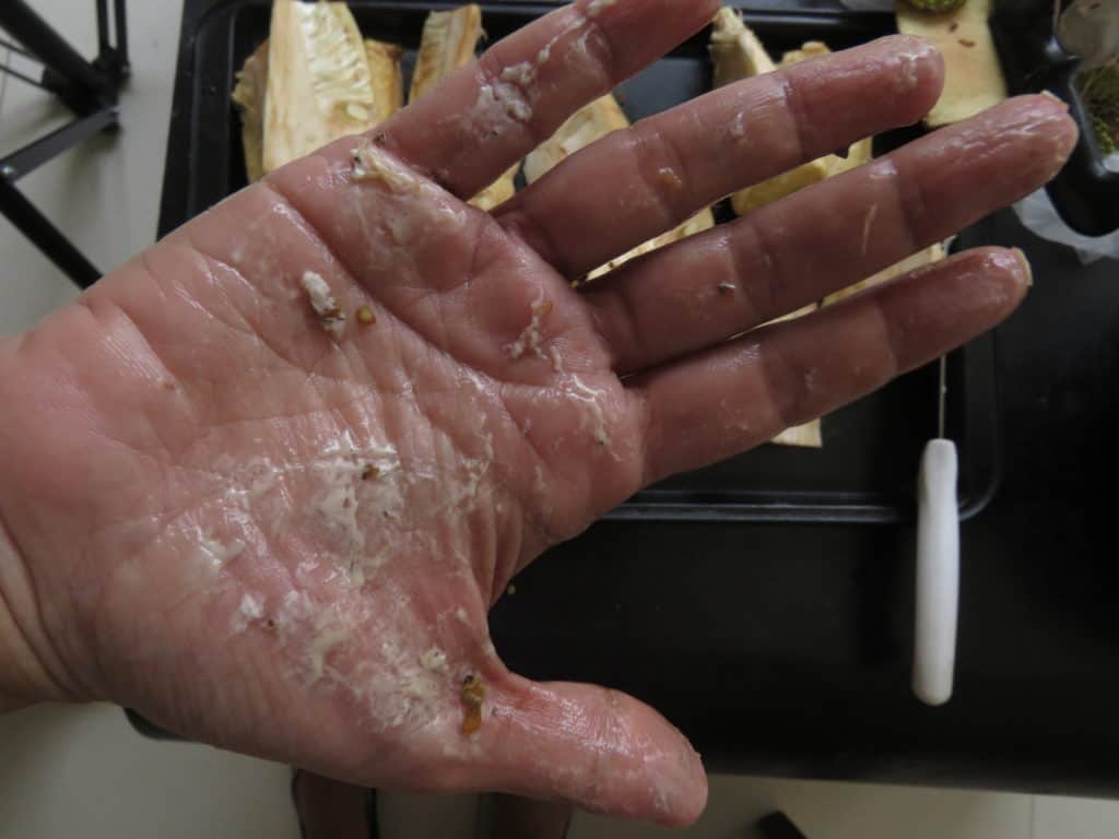 baby jackfruit sap staining hands that are now covered with disposable gloves.